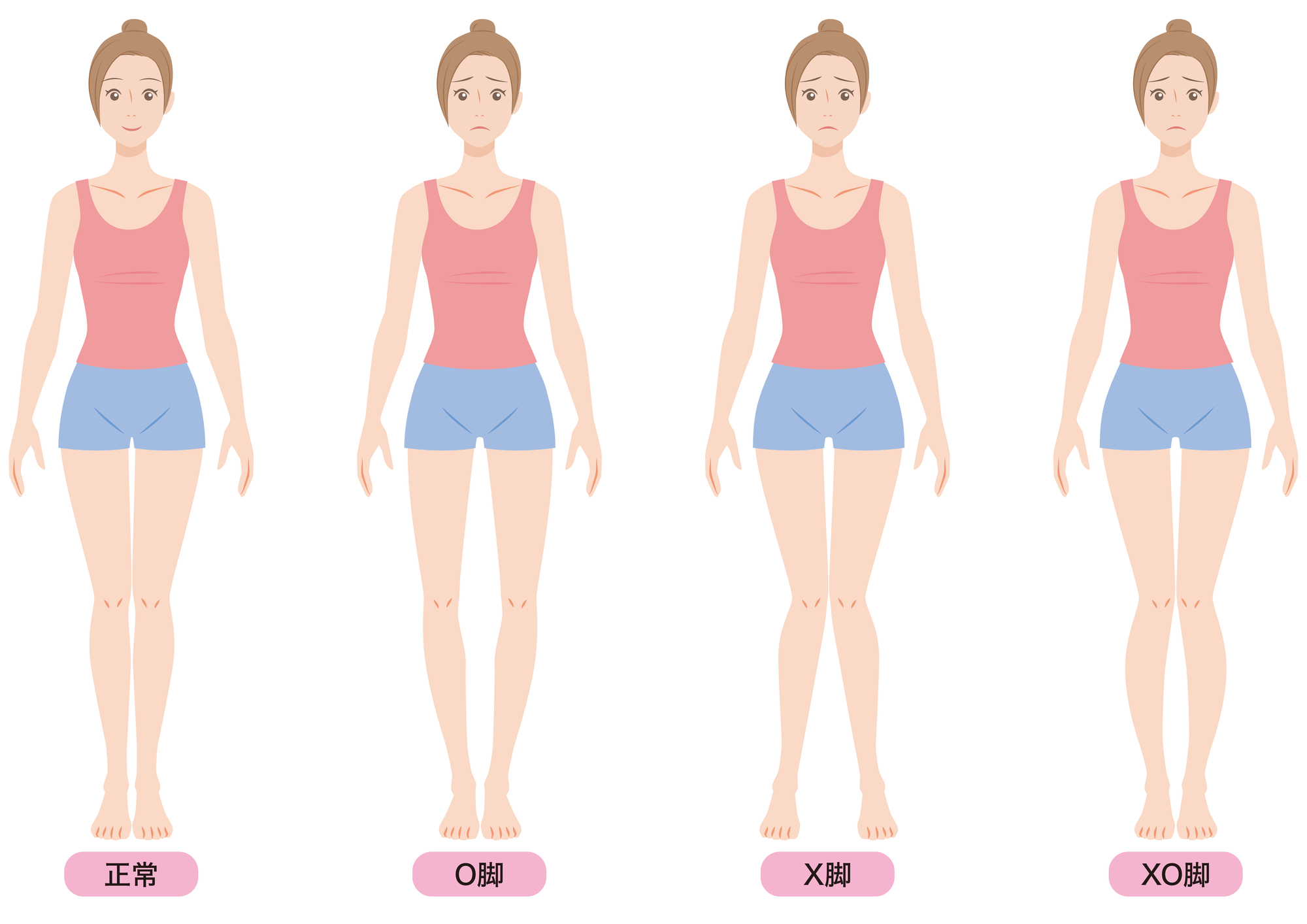 【完全ガイド】O脚・X脚・XO脚の違いとは?原因とピラティスでの改善方法をわかりやすく解説!