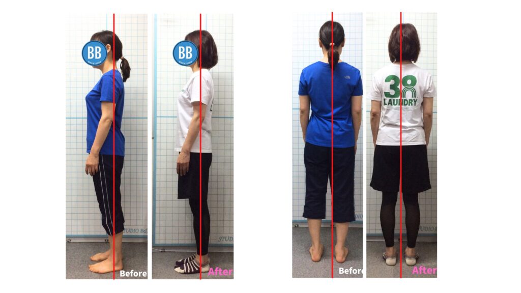 ピラティススタジオBB錦糸町の50代女性・Y.M様の姿勢変化の写真