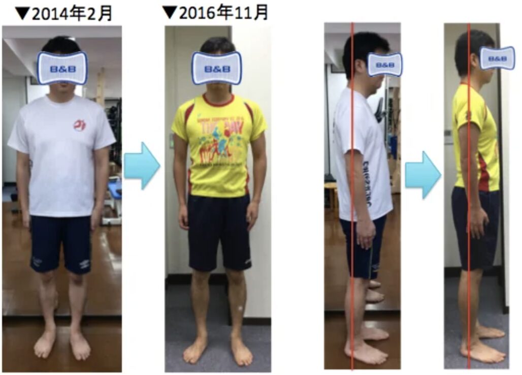ピラティスで−8kgと身長1.5cmアップを実現|ダイエット&姿勢改善の成功事例