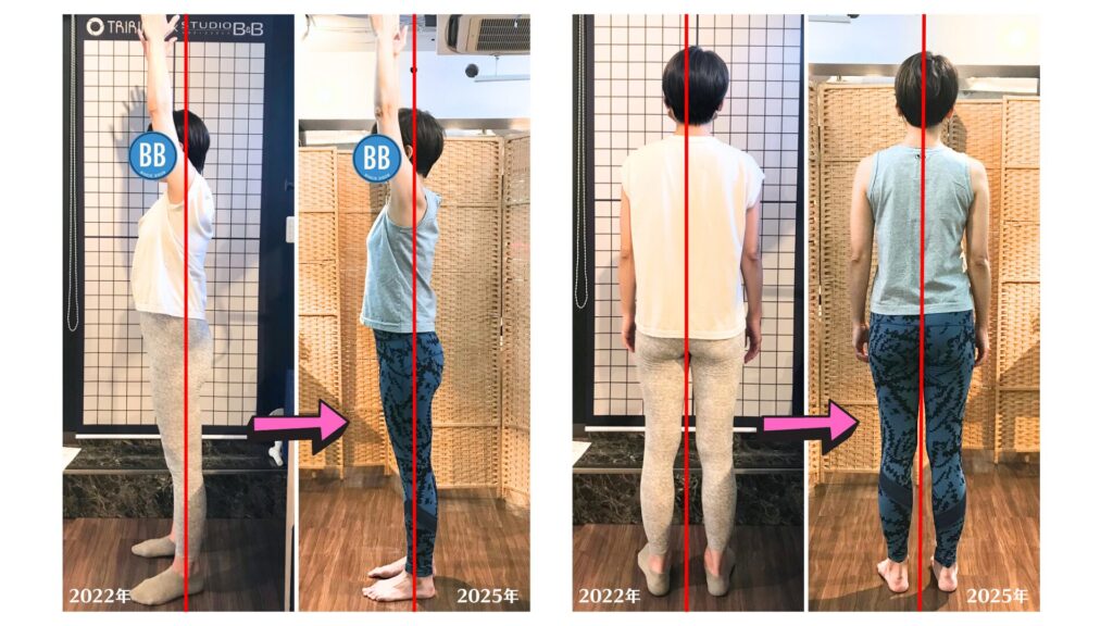 2022年から2年間通ってくださっているN様。背中や肩の動きが向上し、お腹の感覚が入ったことで反り腰が軽減。