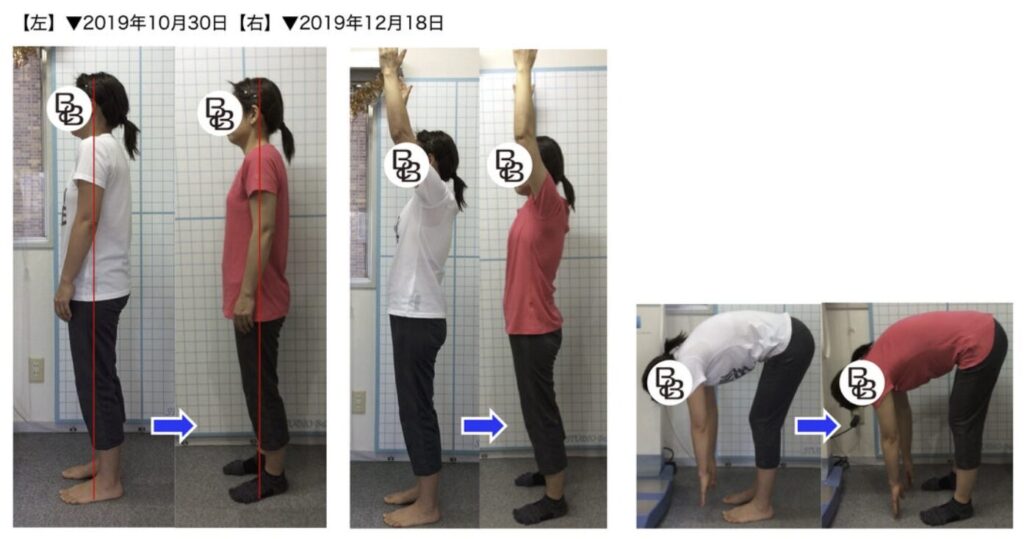 ピラティススタジオBB 錦糸町の会員様が週1・1ヶ月のピラティスセッションで、腕上げや前屈の可動域が改善して比較写真
