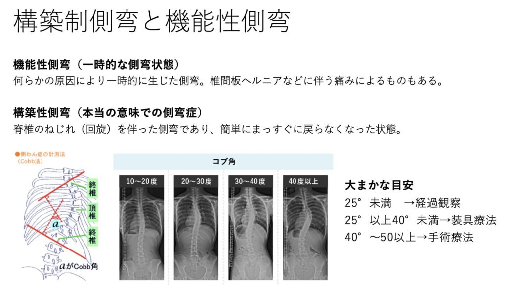 ピラティススタジオBB代表の田沢が作成した、「構築性側弯」と「機能性側弯」との違いを解説した説明文つきイラスト