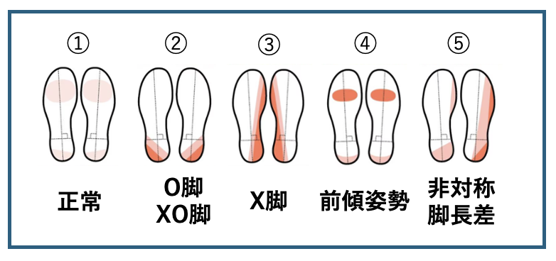 靴の踵のすり減りと姿勢の関係|ピラティスで整える美しい歩き方