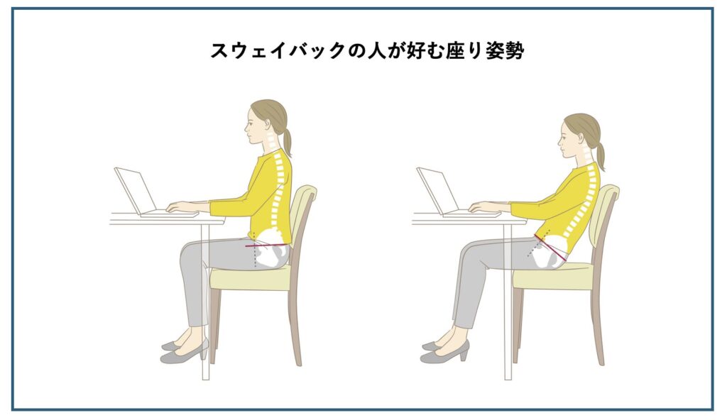 正常な座り姿勢と骨盤後傾の座り姿勢を比較したイラスト