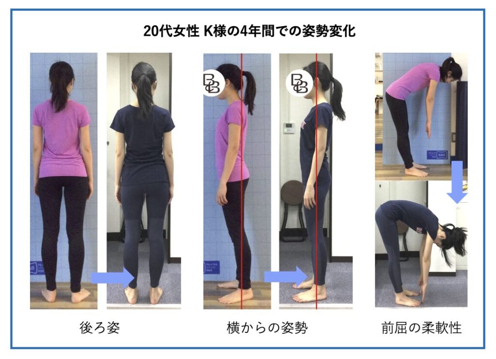 ピラティススタジオBB 田町に4年間通っていただいるK様の姿勢・柔軟性の比較写真