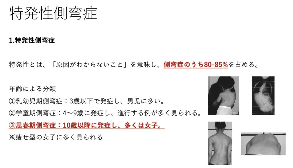 特発性側弯症と思春期側弯症について解説した文章つきイラスト