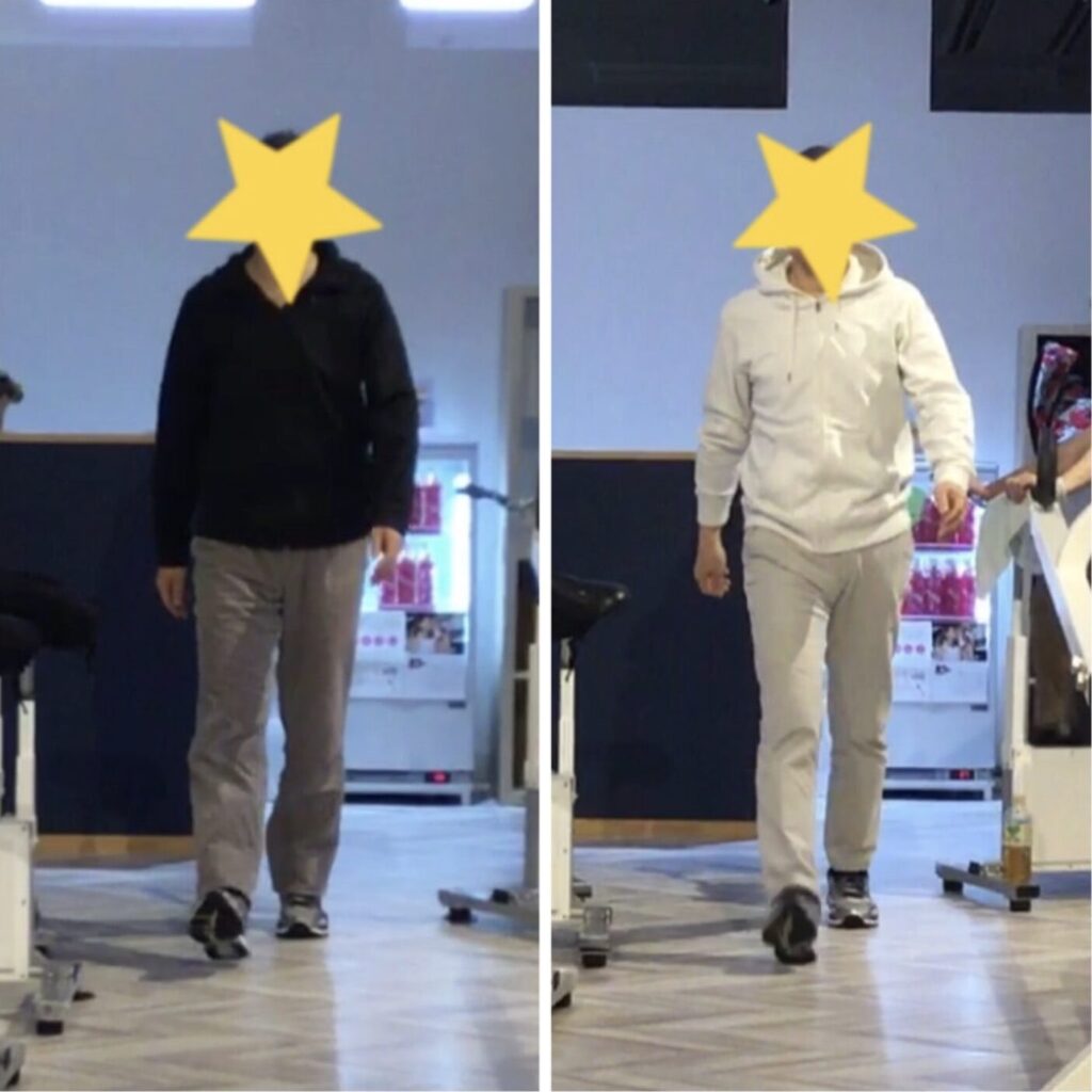 ピラティススタジオBB仙台泉｜脳梗塞リハビリ後の機能回復。右足着地の歩行比較写真（改善前と改善後）