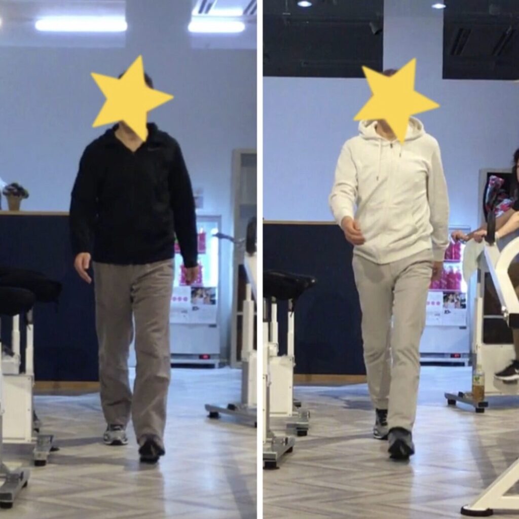 ピラティススタジオBB仙台泉｜脳梗塞リハビリ後の機能回復。左足着地の歩行比較写真（改善前と改善後）