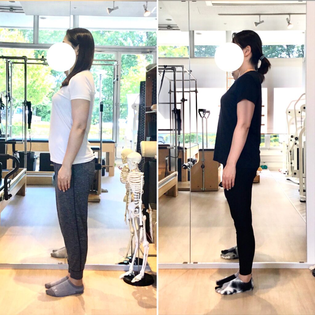 ピラティススタジオBB仙台泉店に通う会員様の姿勢比較の写真。