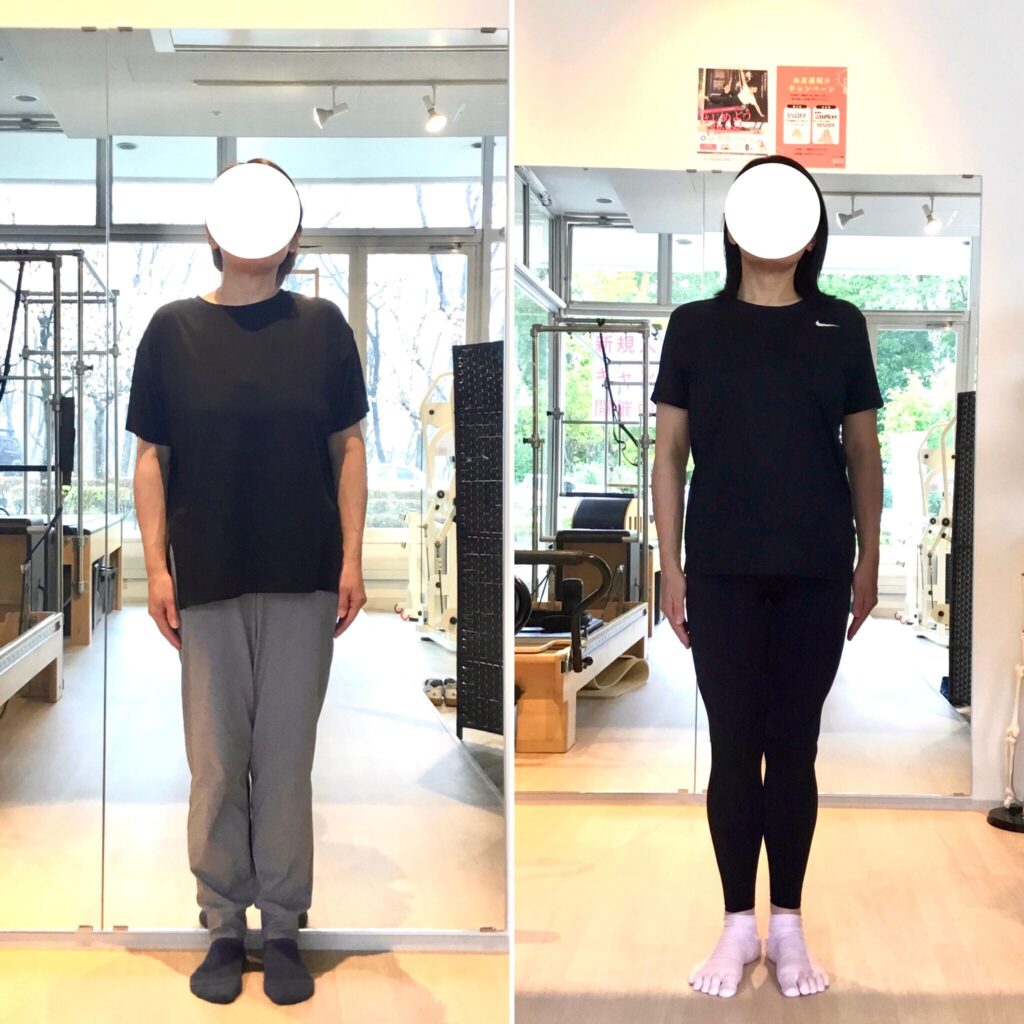 ピラティススタジオBB仙台泉店に通う50代女性の姿勢比較の写真。
猫背が改善し肩の左右差が整っている。