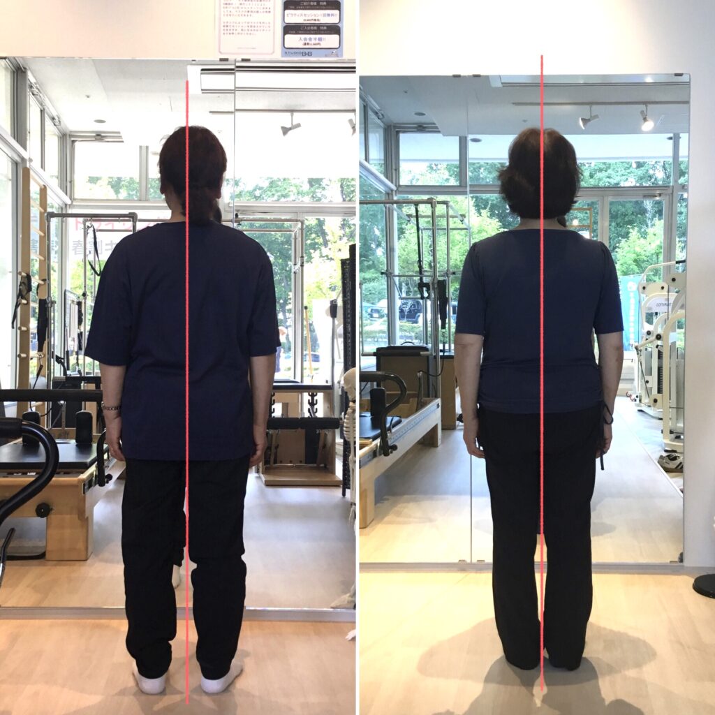 ピラティススタジオBB仙台泉店にかよう70代女性の後ろからの姿勢比較写真の画像
