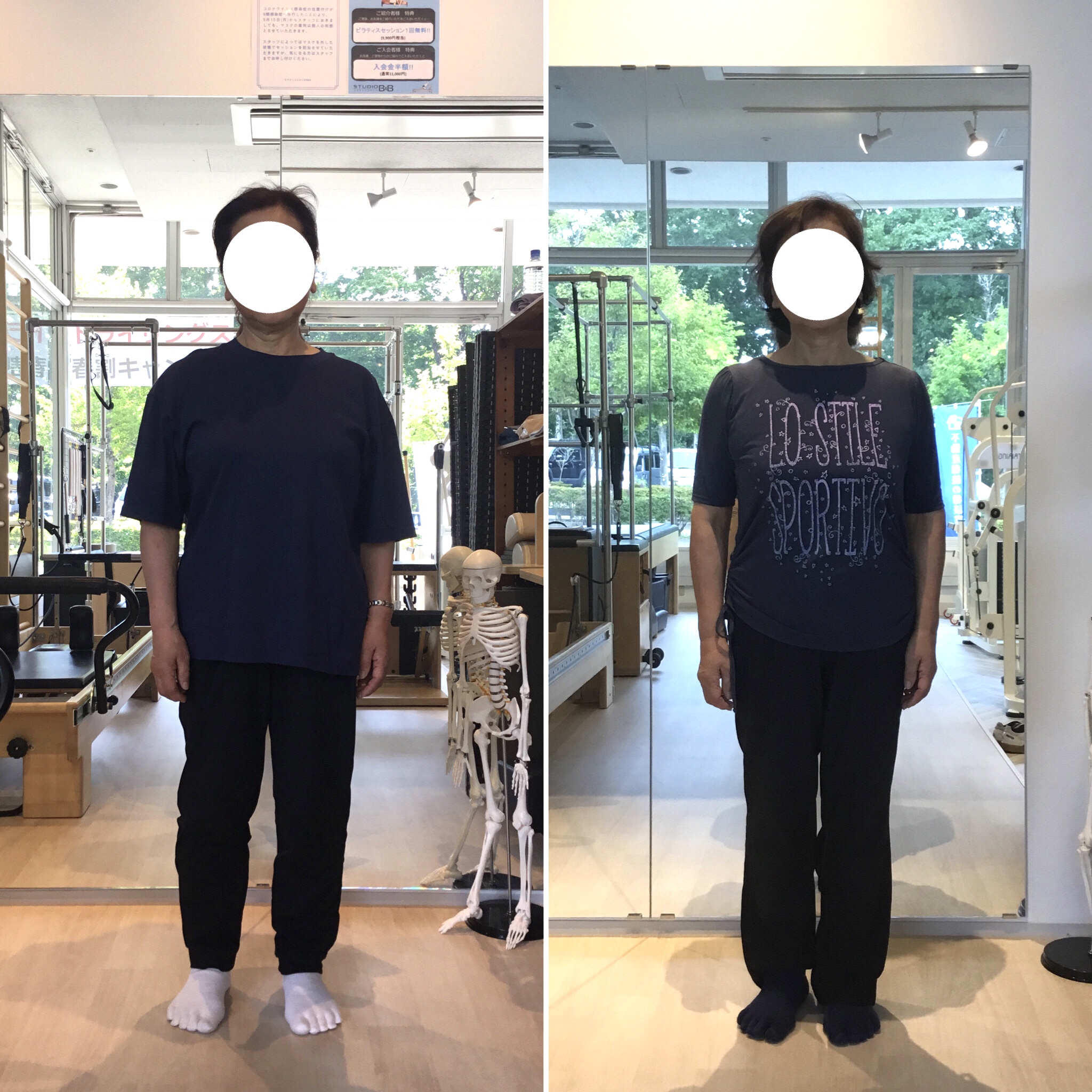 【70代女性】自分の体は自分で守りたい！｜ピラティススタジオBB仙台泉