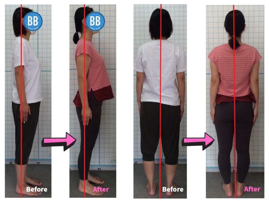 産後5ヶ月で再開されたY様(40代女性)の変化をご紹介｜ピラティススタジオBB 錦糸町