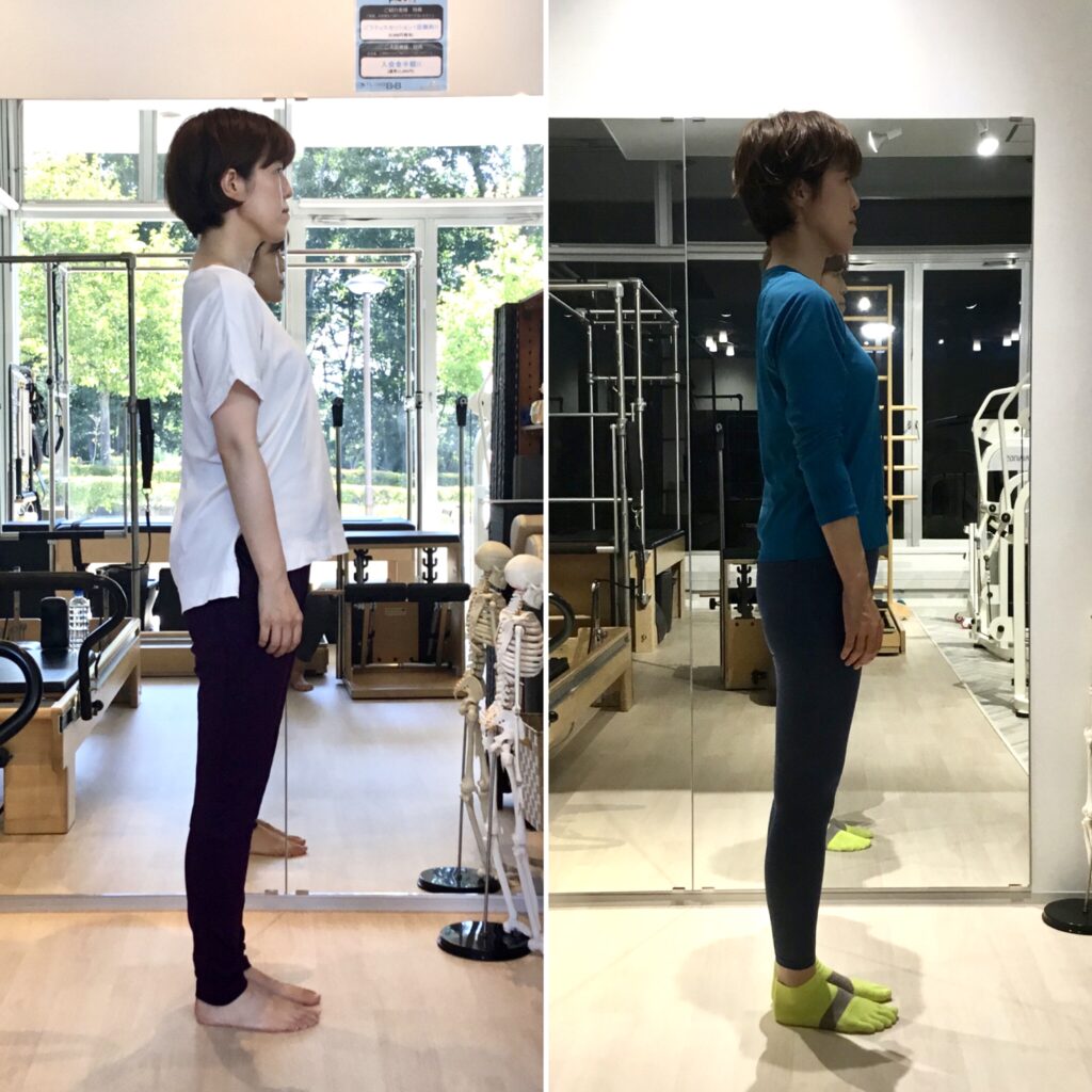 ピラティススタジオBB仙台泉店に通う会員様の右側の姿勢比較写真。猫背や首の位置が改善し姿勢が改善されている。