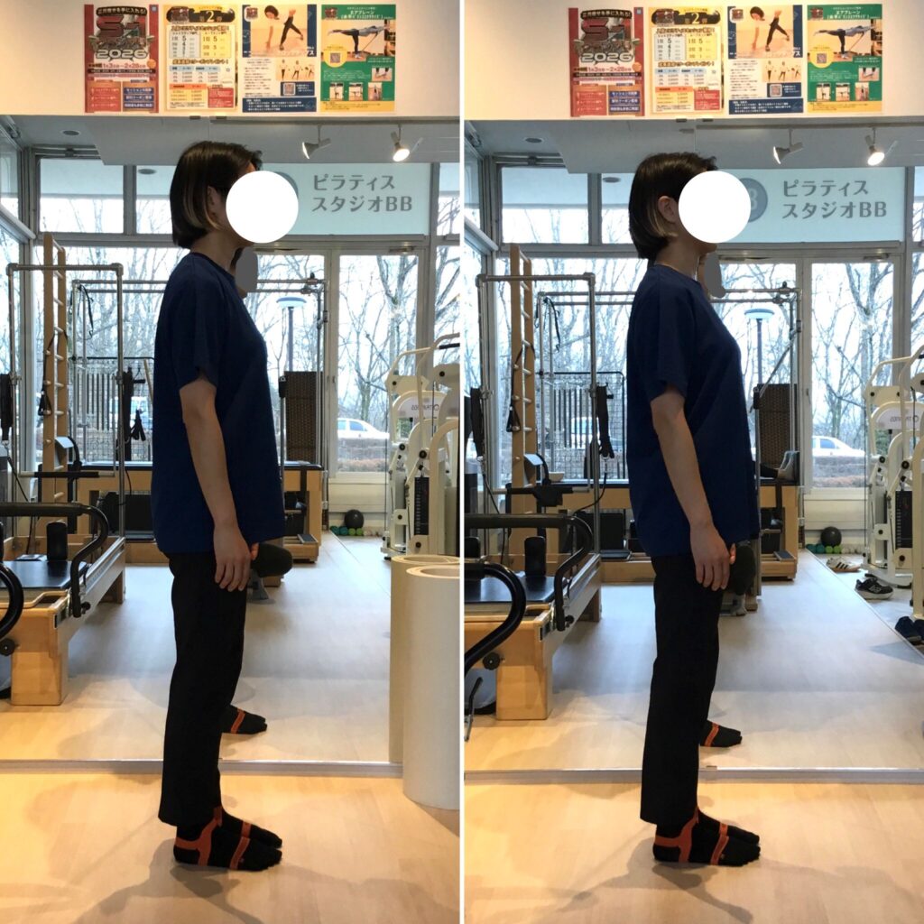 ピラティススタジオBBのスタジオ内で撮影された、同一人物の立ち姿を左右で比較した写真です。「猫背・前傾気味の姿勢」が「体の軸が整った正しい立ち姿」に改善されたビフォーアフター写真です。
