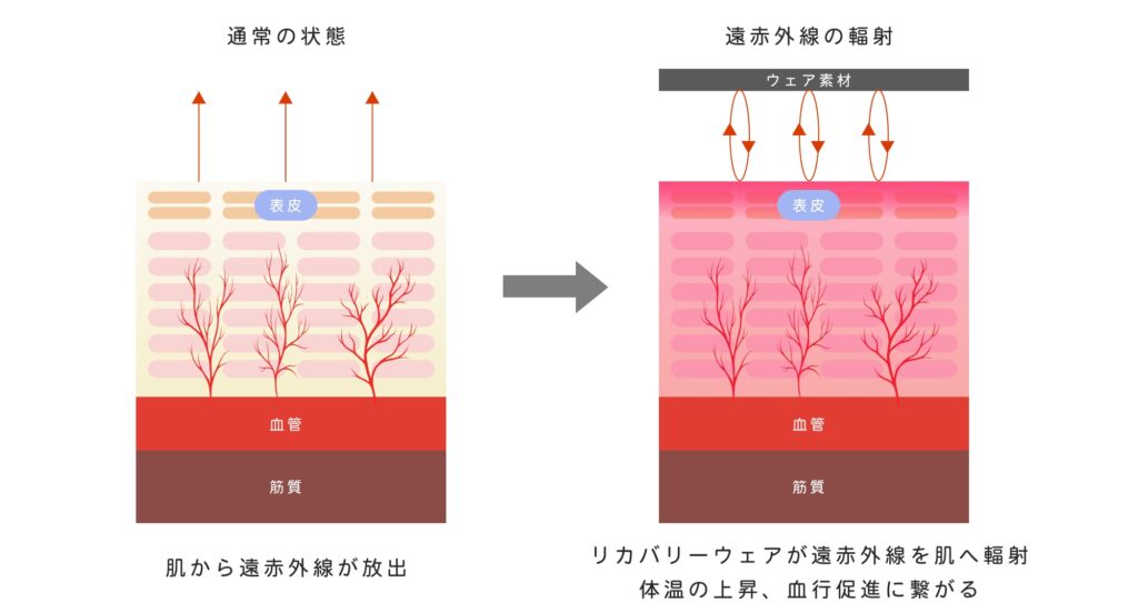 リカバリーウェアにおける輻射のメカニズム
