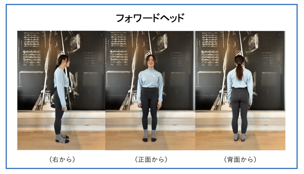 頭部前方姿勢を横・正面・背面から撮影した画像