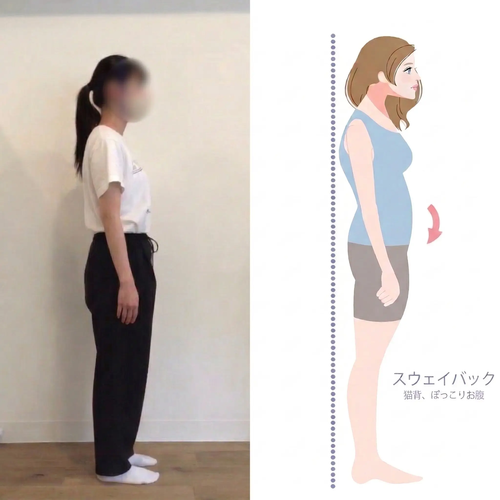 【20代女性】反り腰・猫背が3ヵ月で変化｜スウェイバック姿勢を改善したパーソナルマシンピラティスの実例