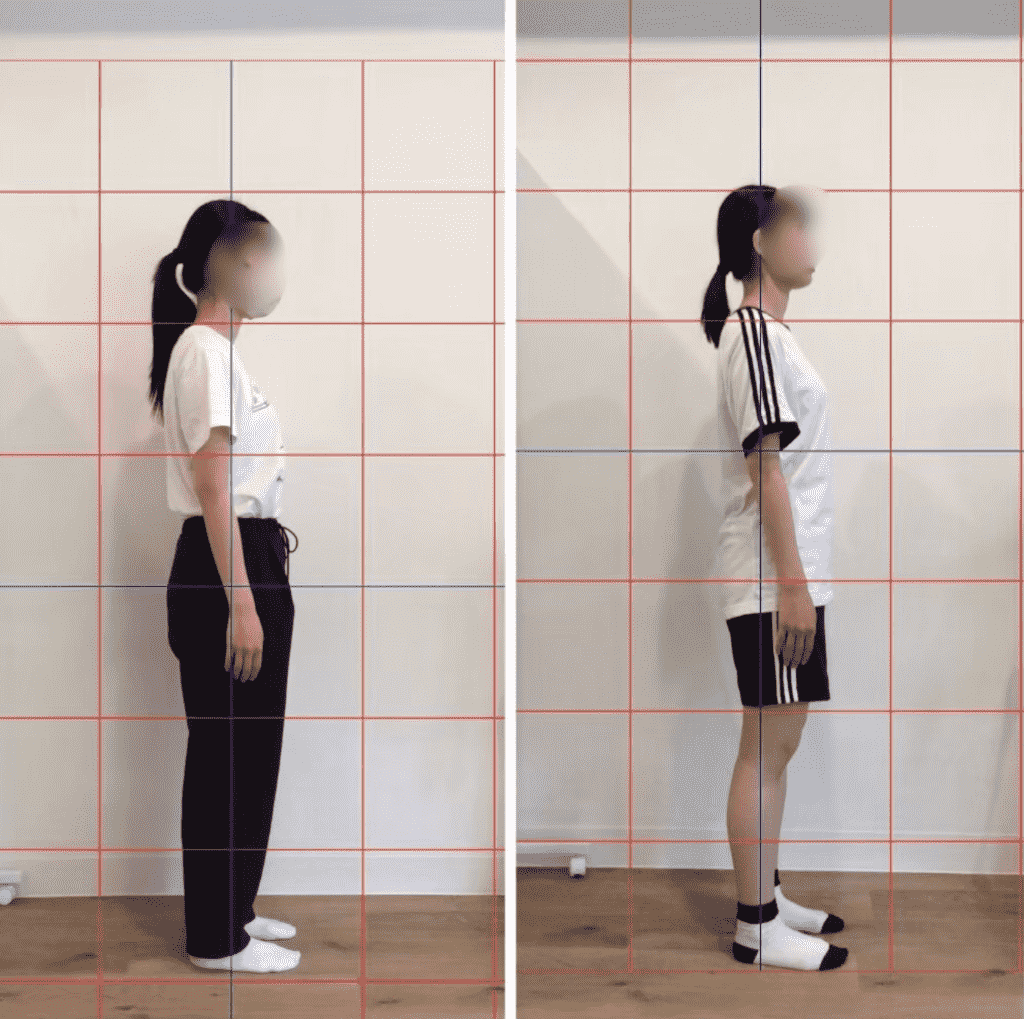 20代女性スウェイバックが解消した姿勢