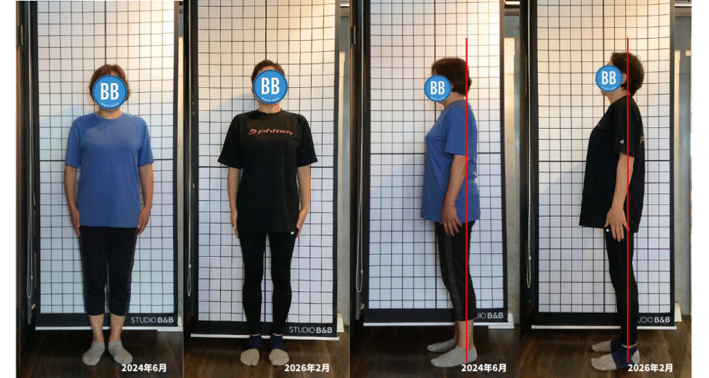 H様の姿勢を比較した写真。左側が正面から、右側が横から撮影したもの。