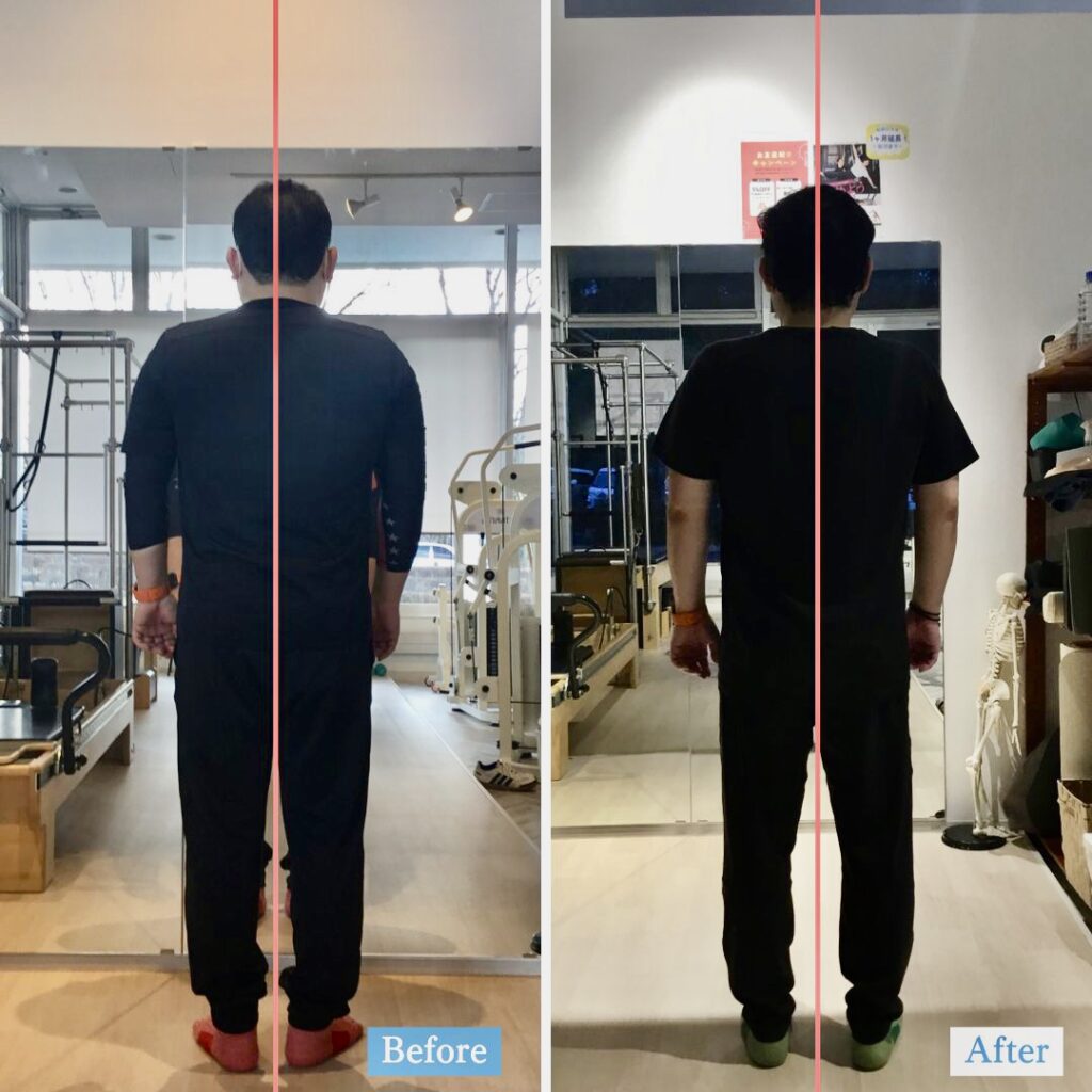 ピラティススタジオBB仙台泉店に通う40代の会員様の後ろから比較した姿勢写真です。