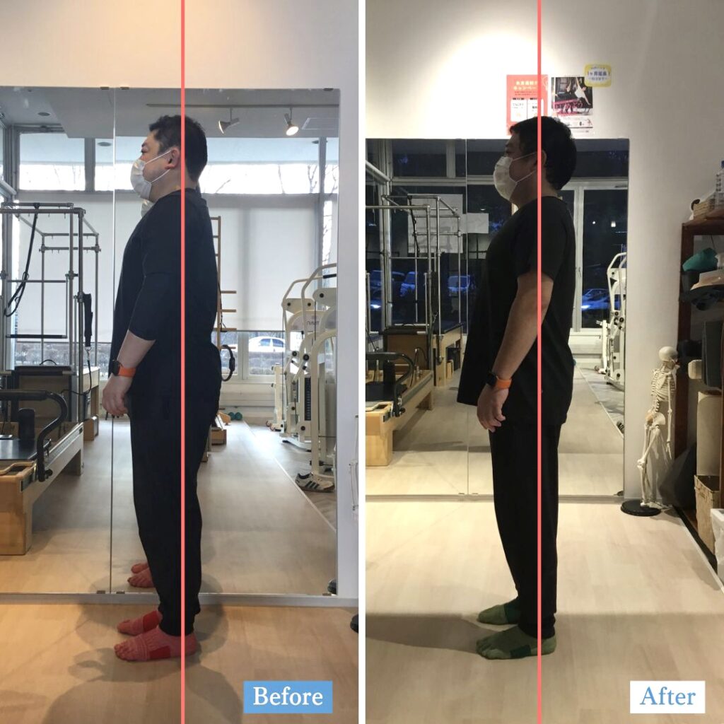 ピラティススタジオBB仙台泉店に通う40代の会員様の横から比較した姿勢写真です。