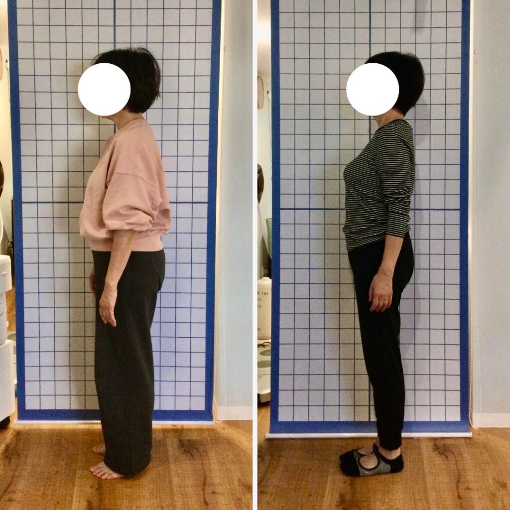 横向きからM.N様の姿勢を比較した写真