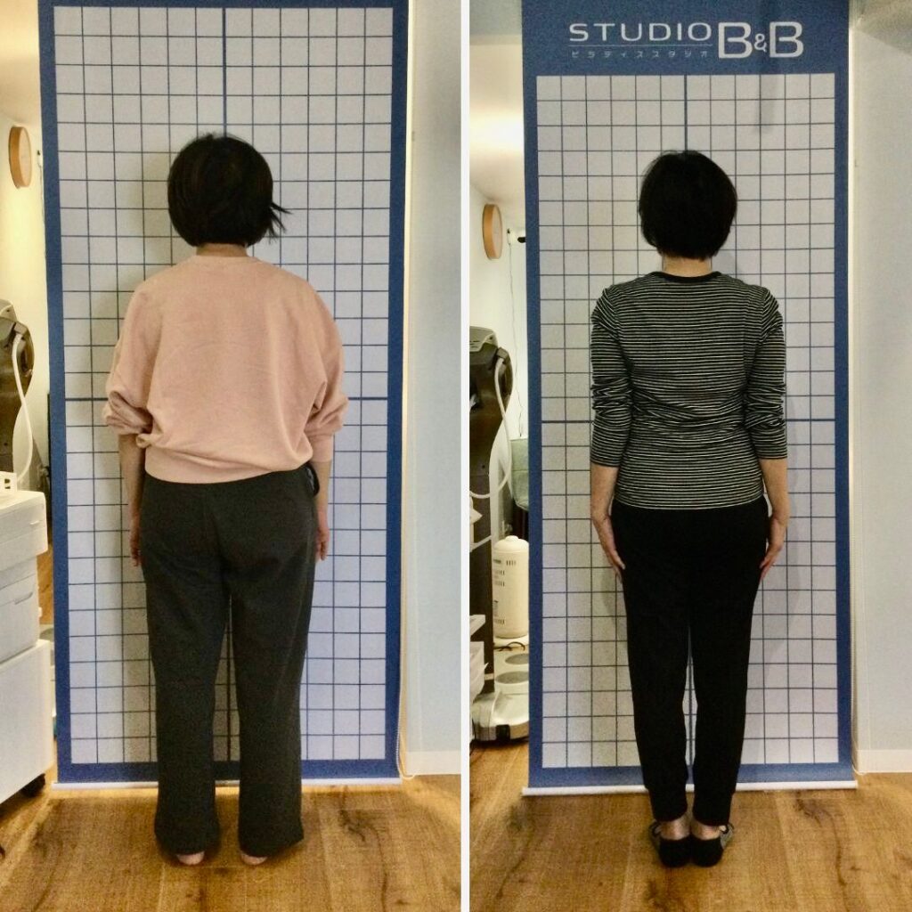 後ろから見たM.N様の姿勢比較の写真
